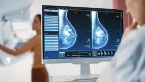 Mamografía en pantalla analizada por inteligencia artificial para la detección temprana del cáncer de mama